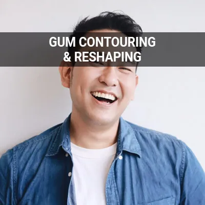 Visit our Gum Contouring and Reshaping page