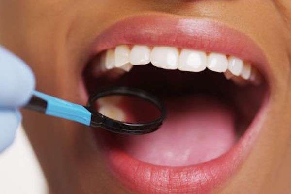 How a General Dentist Treats Cavities from Coronado Dentistry & Pediatrics in Coronado, CA