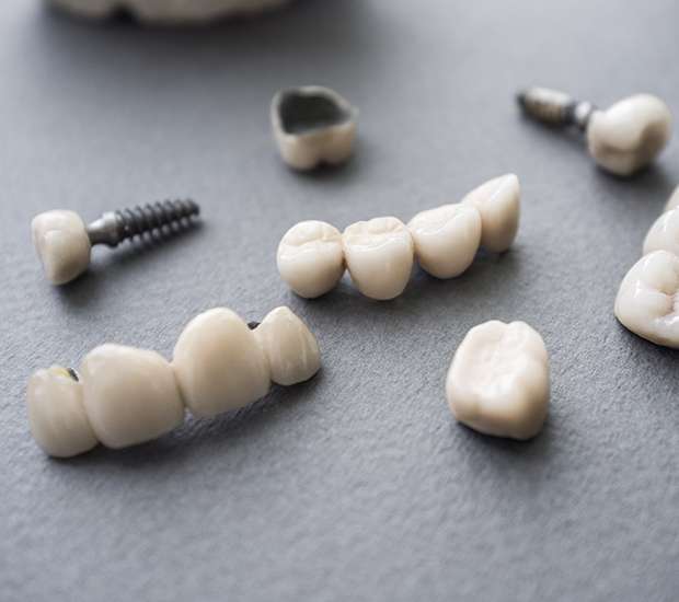 Coronado The Difference Between Dental Implants and Mini Dental Implants